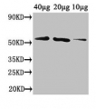 DEGP12 | Putative protease Do-like 12 (mitochondrial)